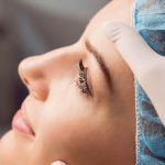 کاشت مو بعد از جراحی بینی