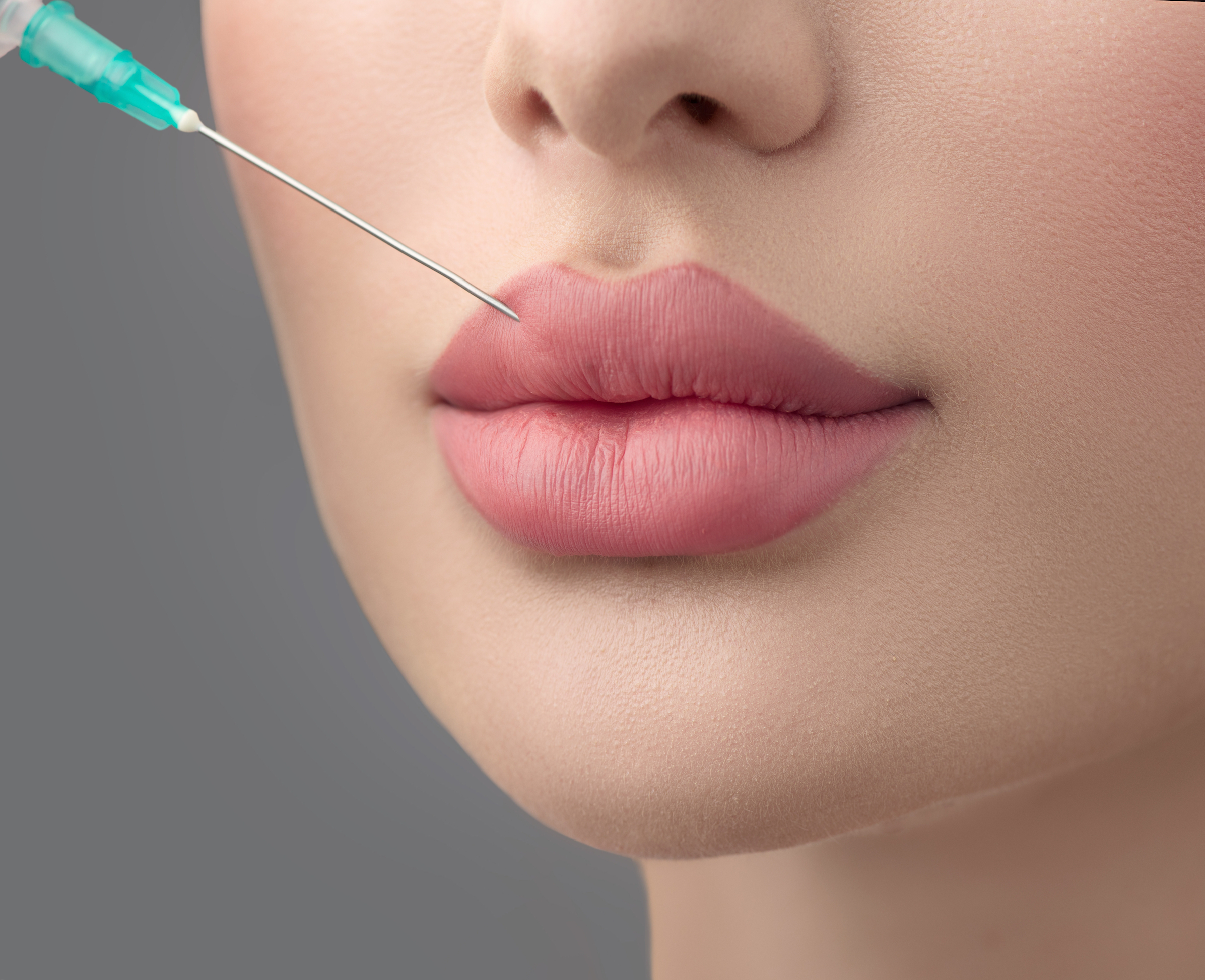 تزریق ژل لب مدل قلبی + عکس های نمونه کار دکتر