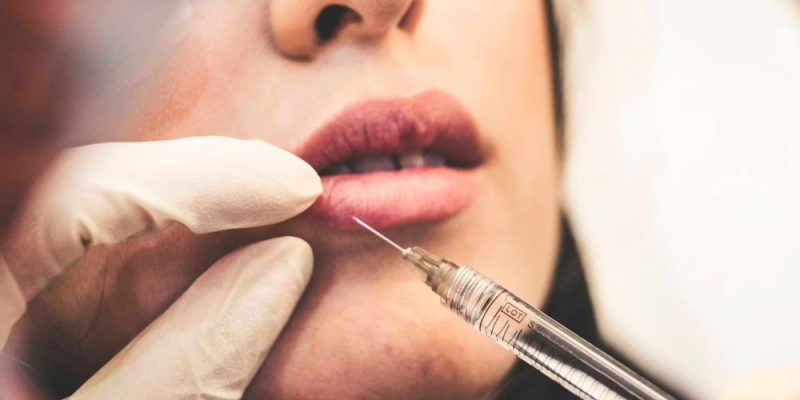 مراقبت هاي بعد از تزريق ژل لب