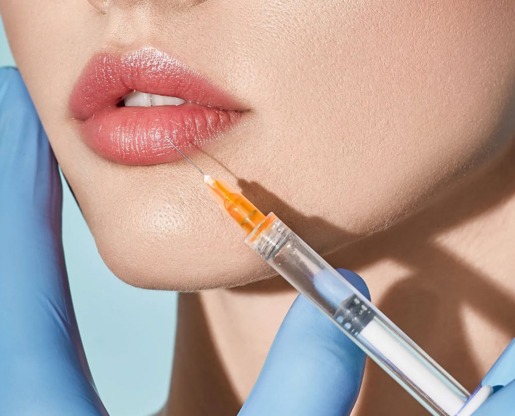 تزریق ژل لب مدل چاک دار + عکس های نمونه کار دکتر