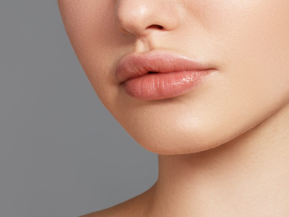 تزریق ژل لب مدل چاک دار
