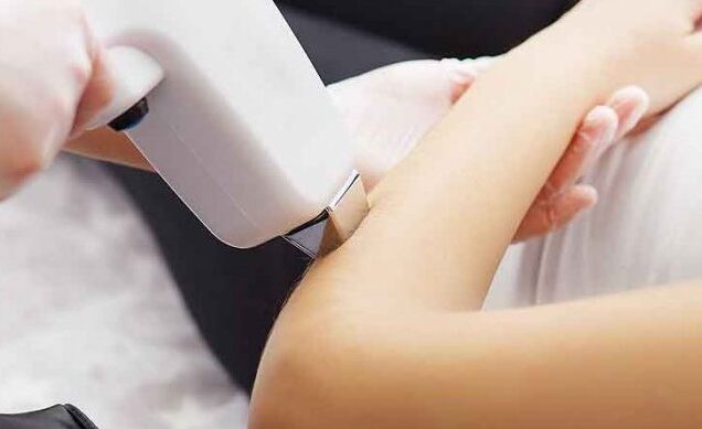 تاثیرات اختلال هورمونی در لیزر موهای زائد