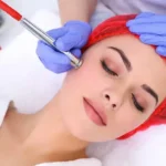 لیزر فراکشنال بهتر است یا میکرودرم ابریژن