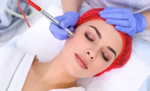 لیزر فراکشنال بهتر است یا میکرودرم ابریژن