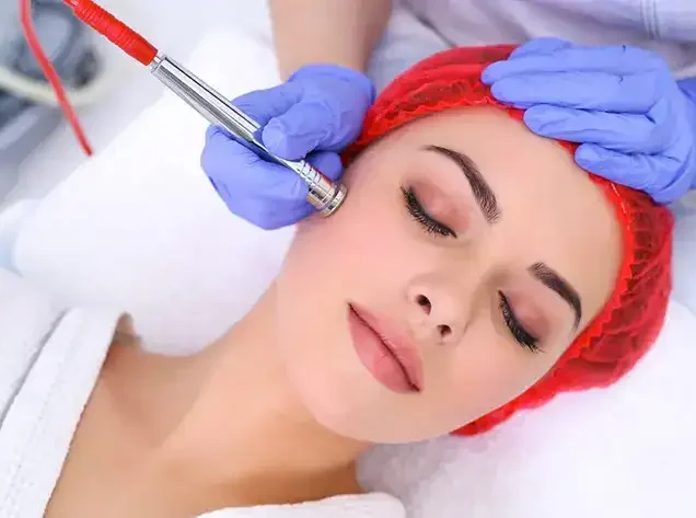 لیزر فراکشنال بهتر است یا میکرودرم ابریژن