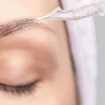 تقویت ابرو بعد از کاشت